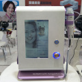 Portable Micro Needle Pment Fractional RF Microneedle Skin Tightening Acne Scar Removal Machine